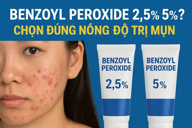 So sánh nồng độ Benzoyl Peroxide 2.5% và 5% trong điều trị mụn trứng cá tại Anh Mỹ Clinic