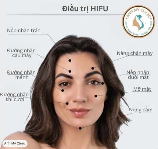 dieu-tri-hifu.jpg Điều trị HIFU