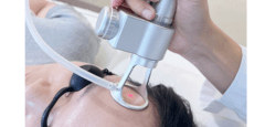 Liệu pháp laser trẻ hóa da
