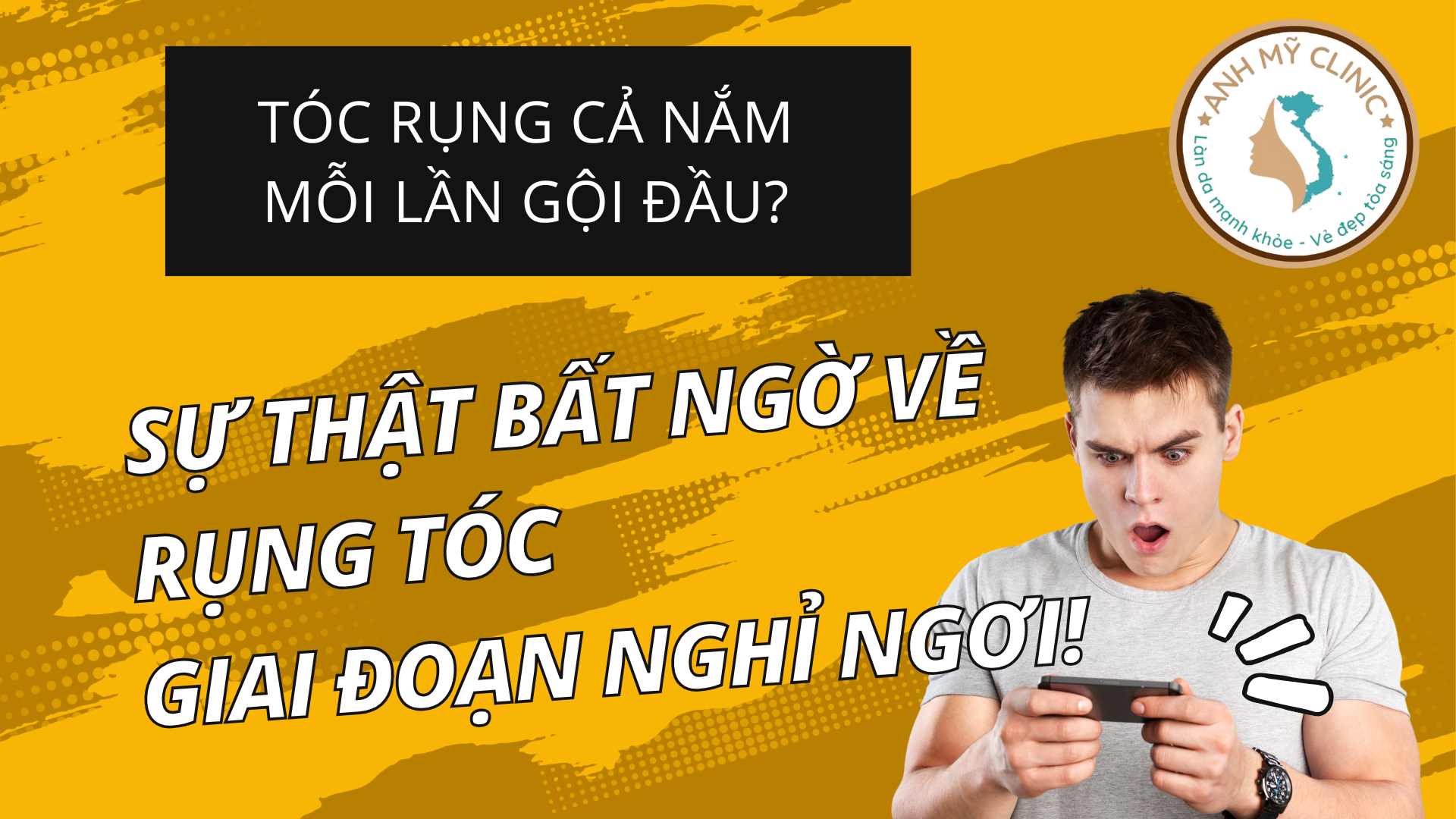Ảnh đại diện video: Rụng Tóc Giai Đoạn Nghỉ Ngơi: Nguyên Nhân, Triệu Chứng và Cách Khắc Phục