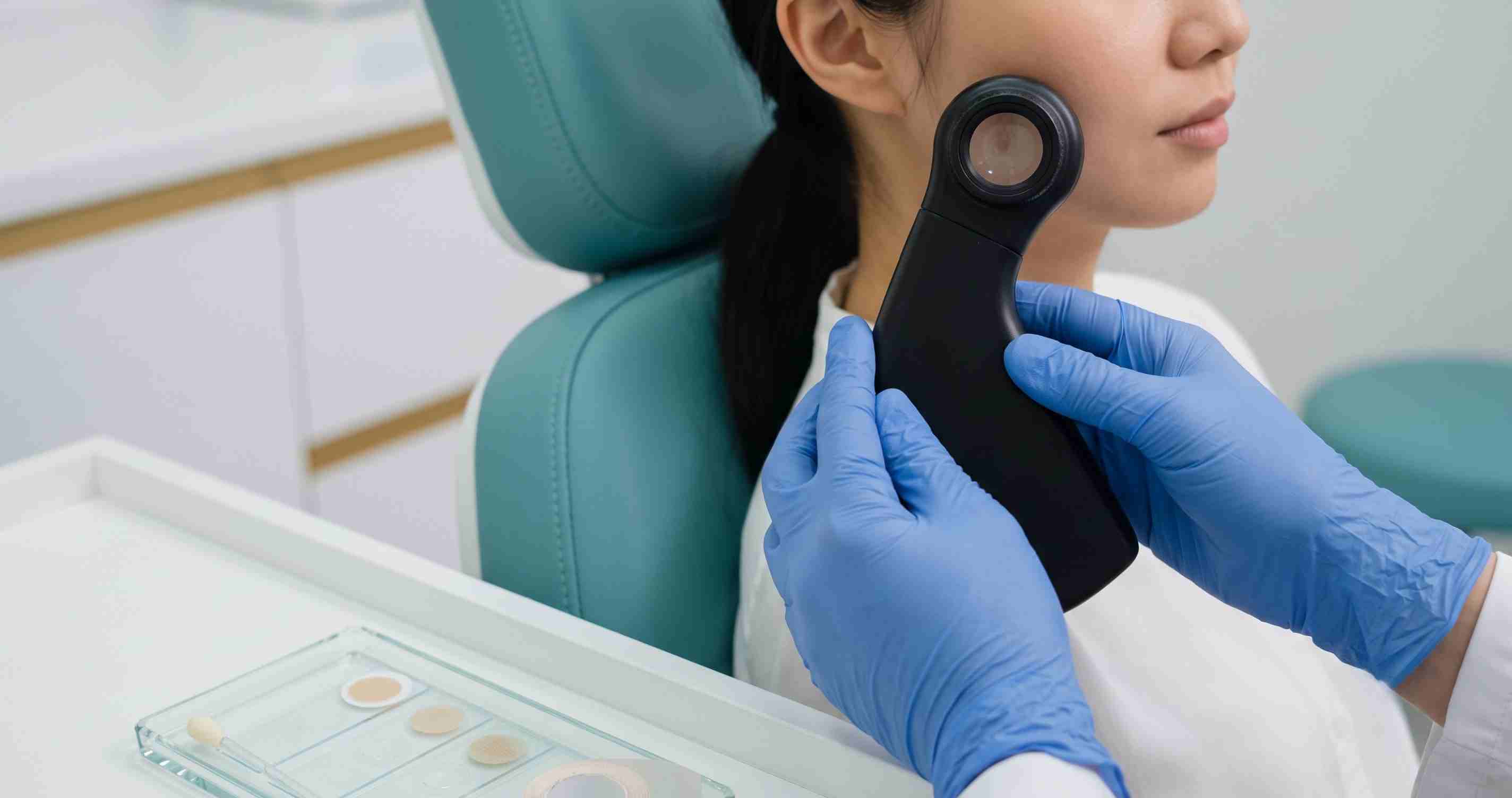 Bác sĩ da liễu soi da chẩn đoán viêm da do Demodex và lấy mẫu SSSB định lượng mật độ ve