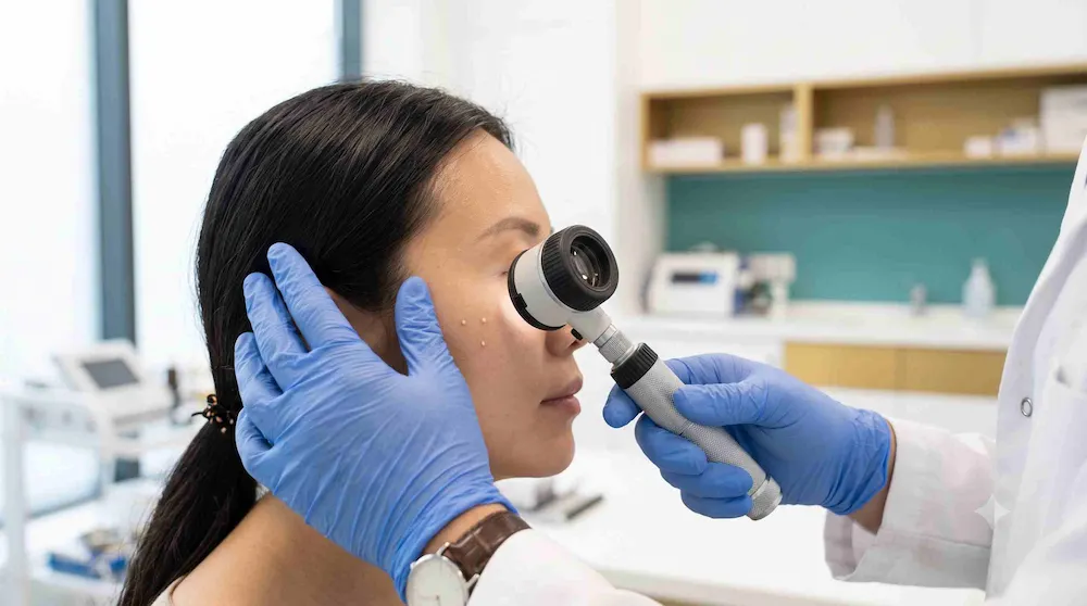 Bác sĩ da liễu soi da đánh giá nốt mụn kê trên mặt và khai thác tiền sử thủ thuật, thuốc bôi