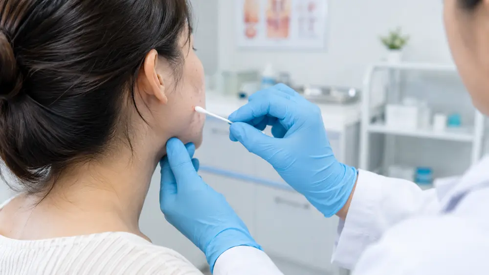 Bác sĩ da liễu soi cấy dịch mủ để xác định viêm nang lông vi khuẩn Gram âm
