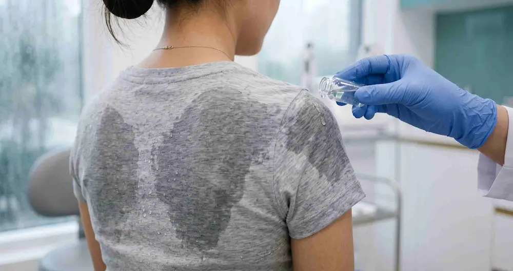 Áo ẩm dính vào lưng khi trời mưa làm tăng nguy cơ mụn ngứa lưng ngực mùa mưa
