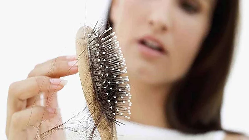 a-p-lu-c-la-nguye-n-nha-n-ha-ng-da-u-ga-y-ra-ti-nh-tra-ng-ru-ng-to-c.jpg Tóc mỏng thưa là dấu hiệu của bệnh gì?