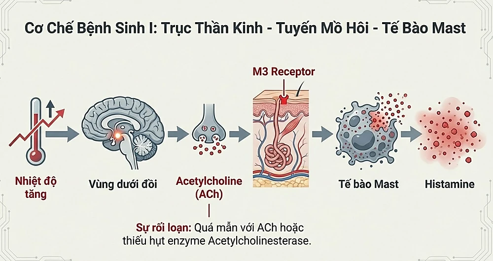 Sơ đồ đồ họa thông tin mô tả cơ chế bệnh sinh của mề đay cholinergic theo trục Thần kinh - Tuyến mồ hôi - Tế bào Mast. Quy trình bắt đầu từ việc nhiệt độ tăng kích thích vùng dưới đồi, dẫn đến giải phóng Acetylcholine (ACh). Sự rối loạn quá mẫn với ACh hoặc thiếu hụt enzyme sẽ kích hoạt tế bào Mast giải phóng Histamine, gây ra phản ứng dị ứng.