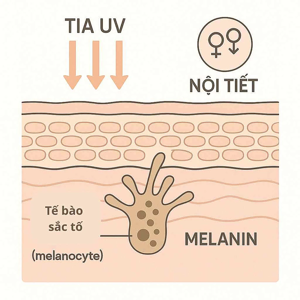 Tia UV và thay đổi nội tiết kích hoạt tế bào sắc tố (melanocyte) sản xuất melanin dư thừa