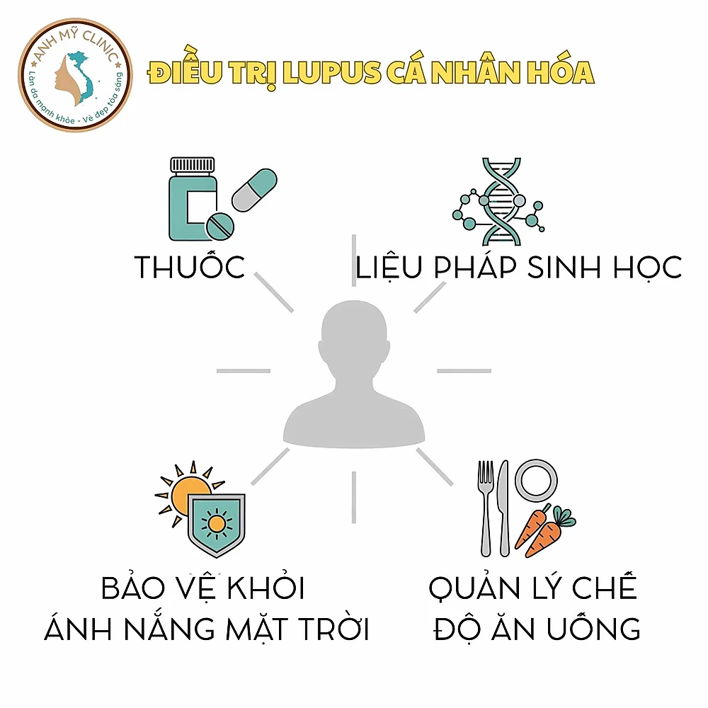 Điều trị lupus ban đỏ cá thể hóa