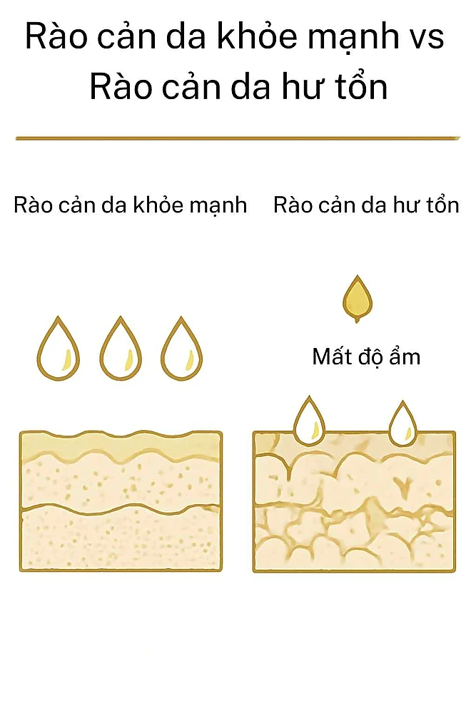 So sánh hàng rào da khỏe và da bị tổn thương, thể hiện sự mất ẩm qua biểu bì (TEWL).