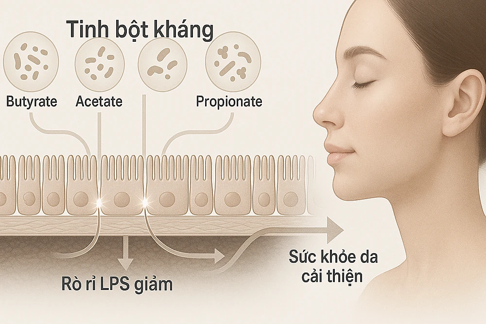 Minh hoạ prebiotic tạo SCFA (butyrate) siết chặt hàng rào ruột, giảm viêm theo trục ruột–da.