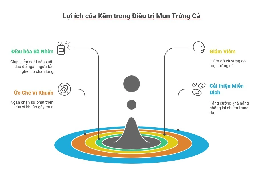 Hình ảnh minh họa lợi ích của kẽm trong điều trị mụn trứng cá, bao gồm việc điều hòa bã nhờn, ức chế vi khuẩn, giảm viêm và cải thiện miễn dịch, giúp điều trị mụn hiệu quả.