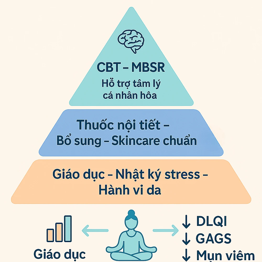 Mô hình điều trị mụn nội tiết phối hợp da – tâm lý – nội tiết của Bs Trương Lê Đạo