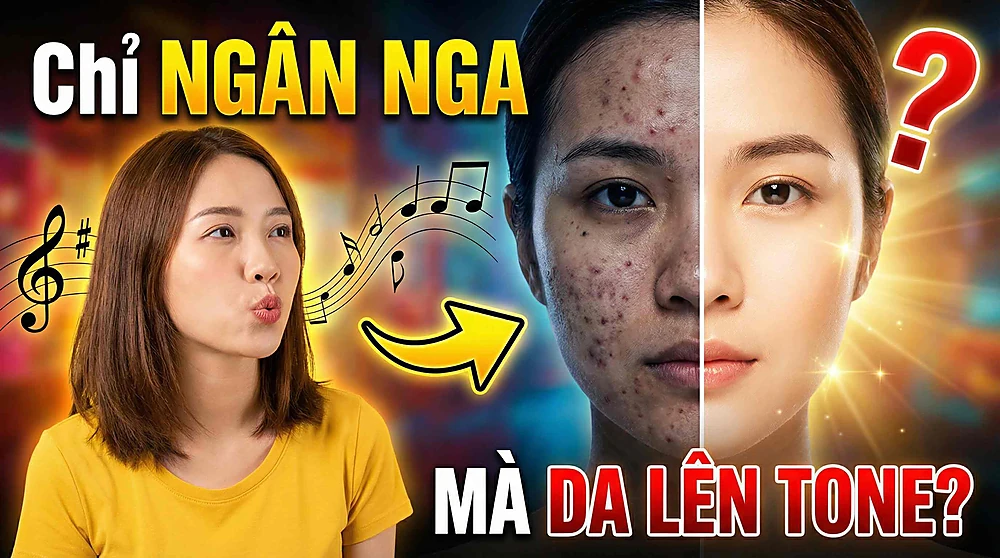 Hình so sánh làn da trước và sau khi điều trị: bên trái là người phụ nữ đang ngân nga các nốt nhạc, bên phải là khuôn mặt chia đôi (một bên mụn, một bên sáng mịn) kèm dòng chữ 