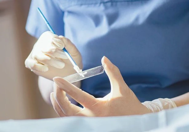 Pap test