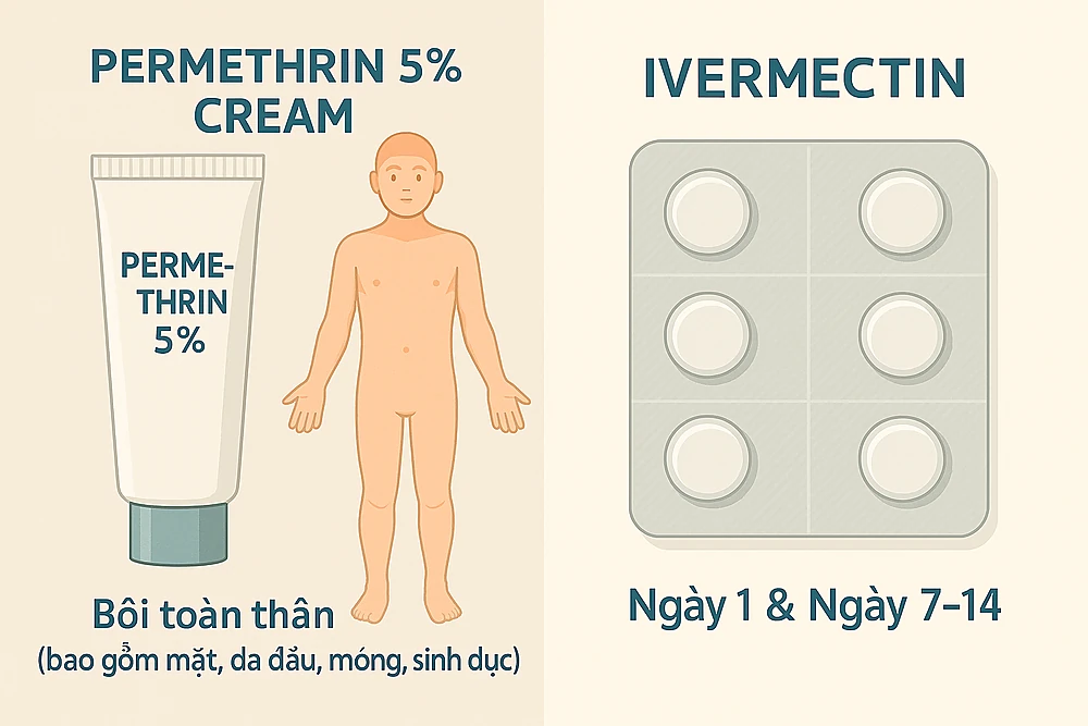 Phác đồ chuẩn  bệnh ghẻ — permethrin 5% bôi toàn thân và ivermectin 2 liều cách 7–14 ngày