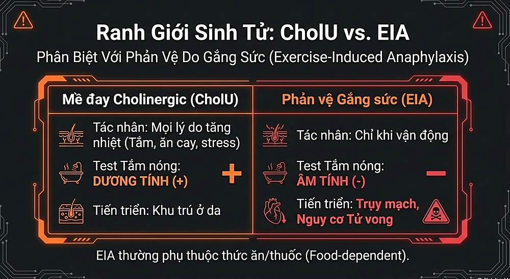 Bảng so sánh cảnh báo phân biệt Mề đay Cholinergic (CholU) và Phản vệ do gắng sức (EIA). Hình ảnh nêu rõ sự khác biệt về tác nhân kích hoạt (nhiệt độ vs vận động), kết quả test tắm nóng (dương tính vs âm tính) và mức độ nguy hiểm (khu trú ở da vs trụy mạch tử vong).