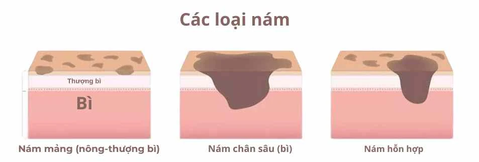 Phân loại nám