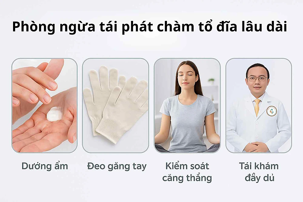 Sơ đồ minh họa các bước phòng ngừa tái phát chàm tổ đỉa: dưỡng ẩm, tránh hóa chất, giảm stress và tái khám định kỳ.
