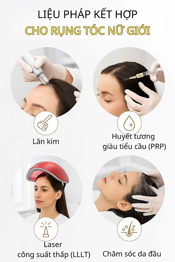 Minh họa các phương pháp hỗ trợ (microneedling, PRP, laser) giúp tăng hiệu quả điều trị rụng tóc kiểu nữ.