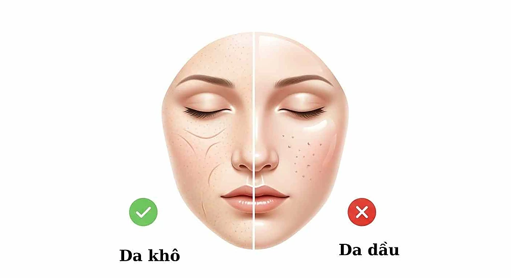 So sánh da khô và da dầu khi thực hiện slugging.