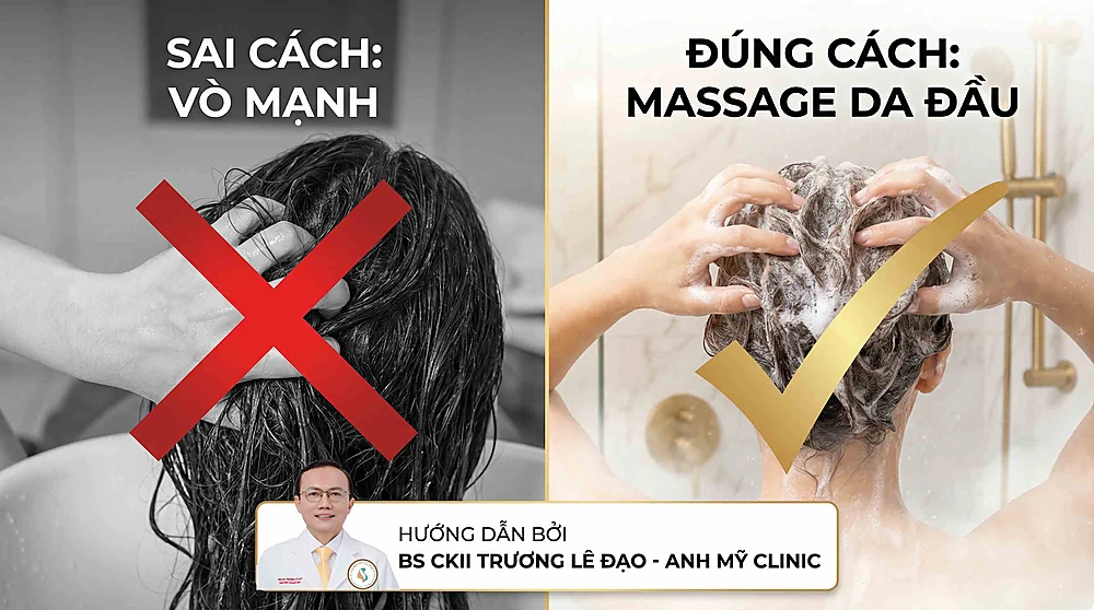 Hình ảnh so sánh sai lầm khi vò mạnh thân tóc và hướng dẫn cách gội đầu đúng cách bằng kỹ thuật massage da đầu từ BS CKII Trương Lê Đạo (Anh Mỹ Clinic).