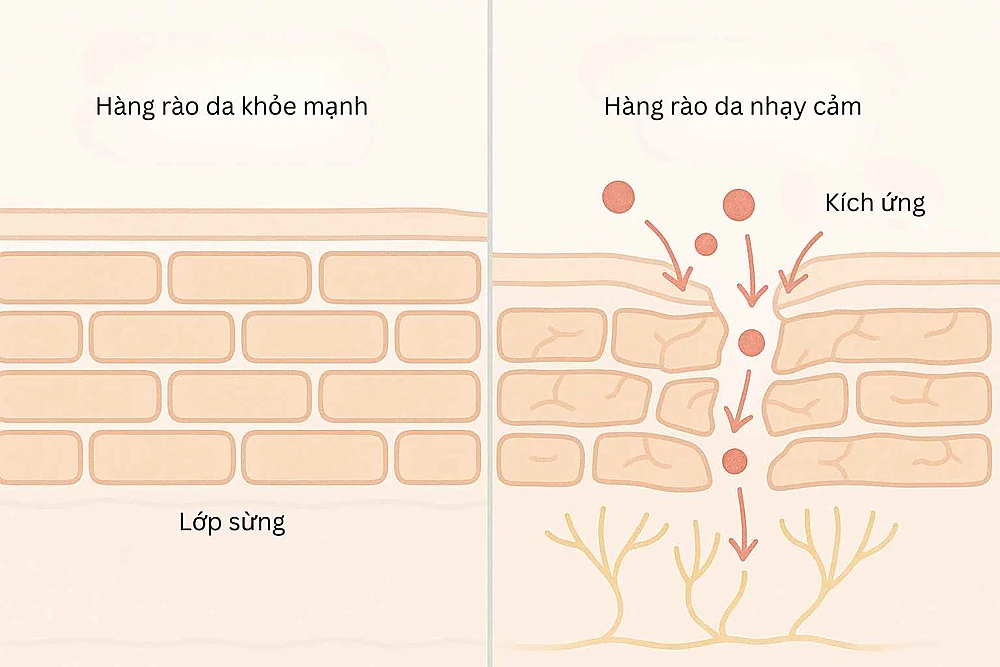 So sánh hàng rào bảo vệ của da khỏe và da nhạy cảm - giải thích từ Bs Trương Lê Đạo.