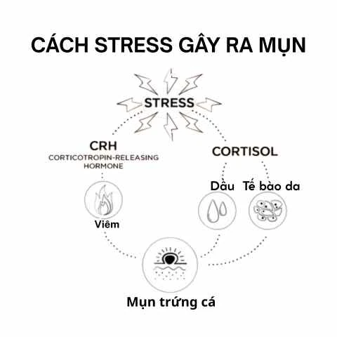 Stress và da dầu mụn