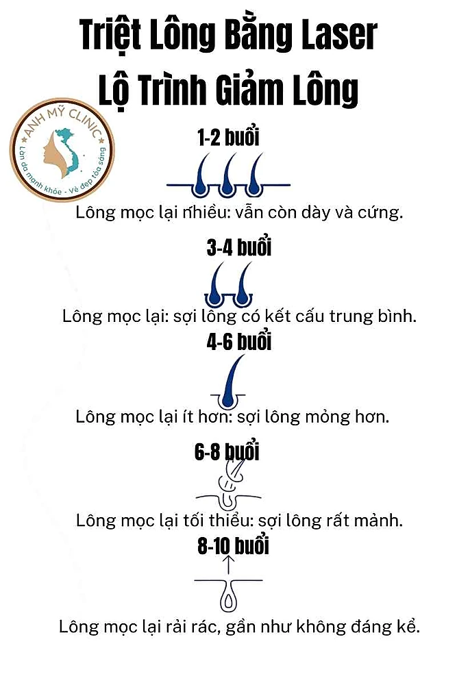 Lộ trình giảm lông 