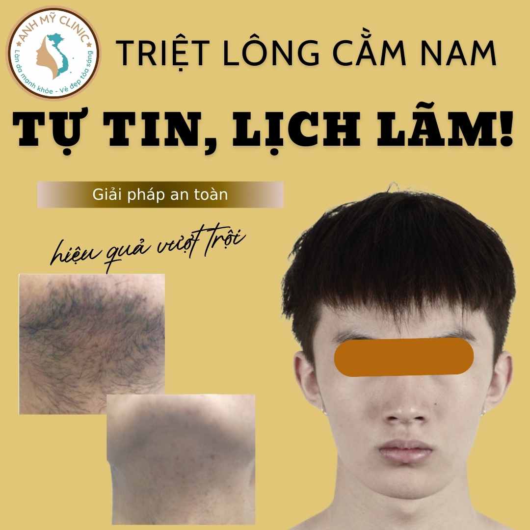 Triệt lông cằm nam giới trước và sau liệu trình
