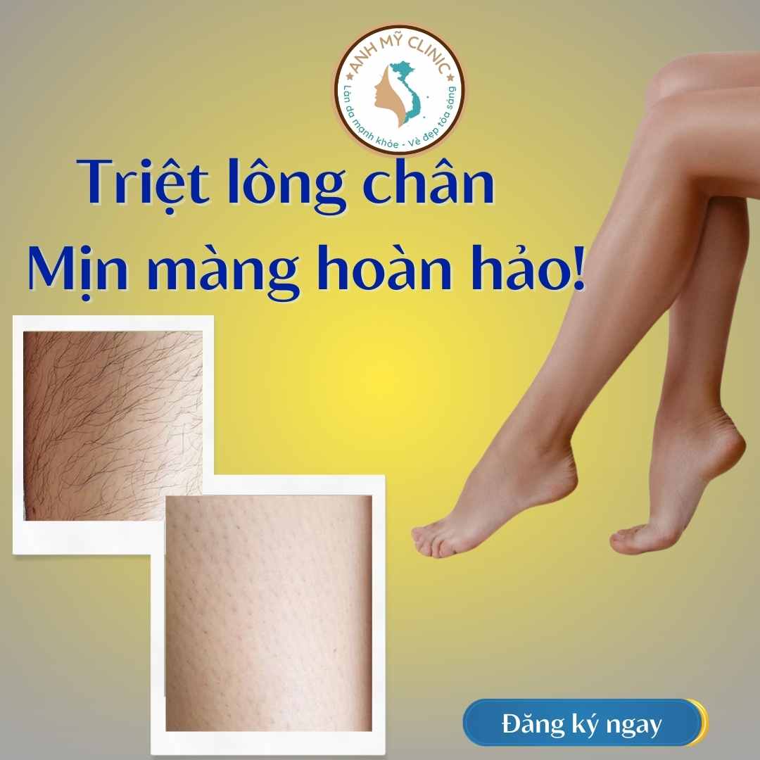 Hình trước sau triệt lông chân bằng laser diode