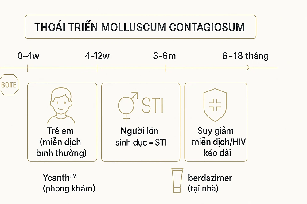  Infographic mốc thời gian khỏi u mềm lây: 0–4 tuần, 4–12 tuần, 3–6 tháng; tự khỏi 6–18 tháng ở miễn dịch bình thường; ca sinh dục/SGMD cần can thiệp; có biểu tượng Ycanth™ và berdazimer, huy hiệu BOTE.